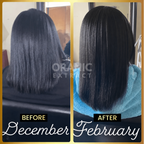 ORANIC EXTRACT® JUMBO Scalp Stimulator